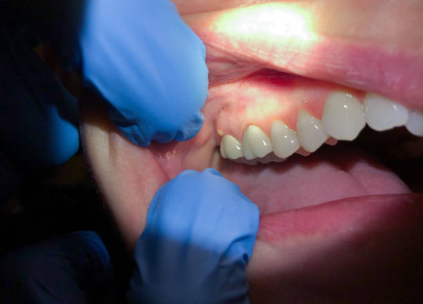 Best Pediatric Emergency Dentist in Auxvasse, MO